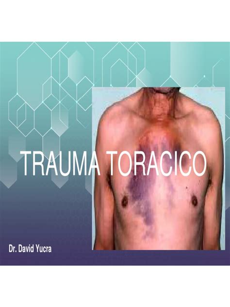 Trauma Toracico Atls Ppdf Pdf Enfermedades Y Trastornos Humanos