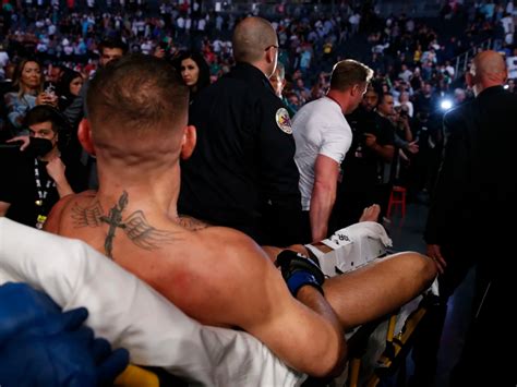 Revelaron Los Detalles De La Impactante Lesi N Que Sufri Conor