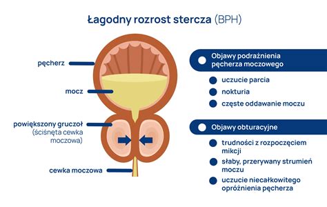 Przerost prostaty jakie są objawy Przyczyny i leczenie przerostu