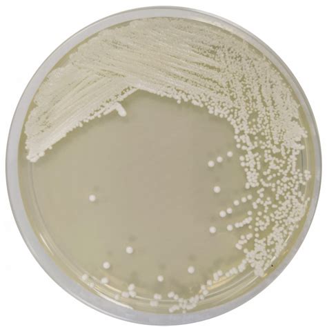 Agar Dextrosa Sabouraud Con Cloranfenicol Epuspiso Formato 500 G