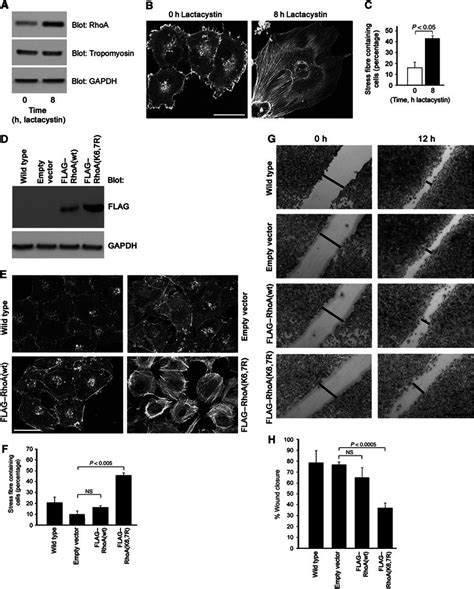 Synaptopodin Induces Stress Fibres And Reduces Cell Migration In Human