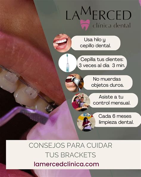 Consejos para cuidar tus brackets Clínica la Merced