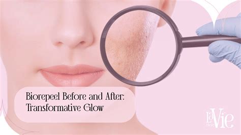 Biorepeel Before and After: Transformative Glow