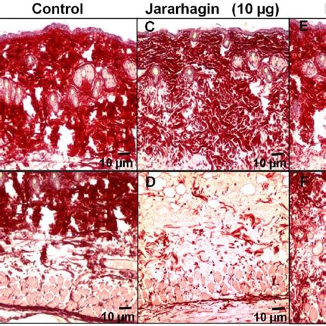 Action Of Jararhagin And BnP1 On The Fibrillar Collagen Matrices