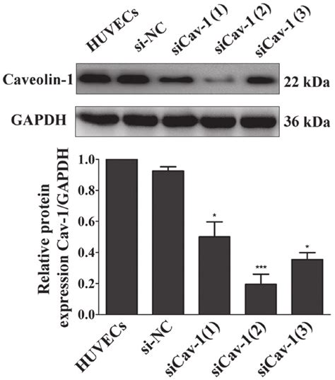 Western Blot Analysis Of Cav 1 Protein Expression In HUVECs Transfected