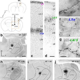 Electron Micrograph Of Bda Labeled Po Thalamocortical Boutons