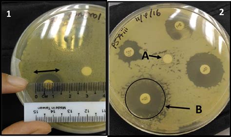 Figure 2 From Antibiotic Susceptibility Of Lactic Acid Bacteria Lab Isolated From Malaysian