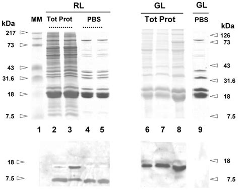 Lids Page Analysis Of Total Proteins And Phycobilisome Preparations