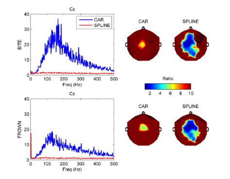 Relative Spectra Of Eyes Closed Vs Left Eye Open Unparalysed