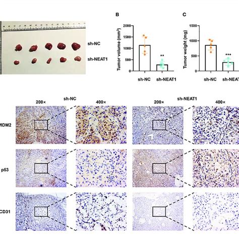 Knockdown Of Neat Suppressed Cancer Progression In Vivo A Tumor