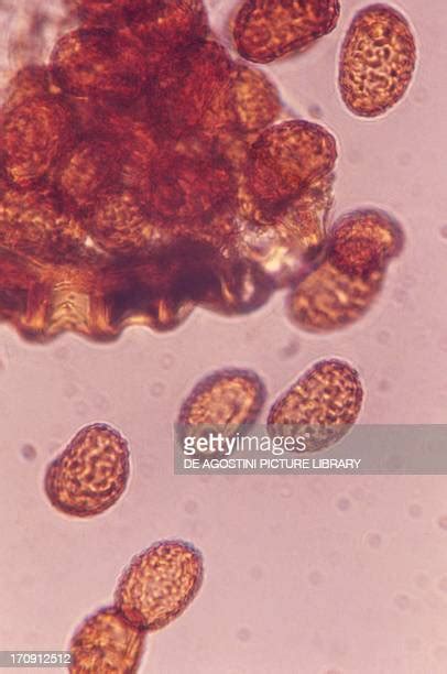 Spore Microscope Photos And Premium High Res Pictures Getty Images