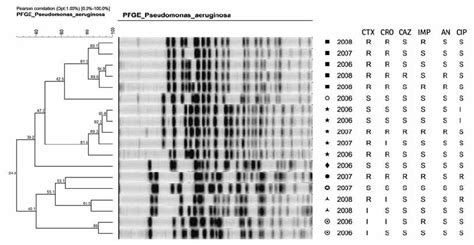 Digitized Pfge Patterns And Dendrogram Of P Aeruginosa Isolates Cut