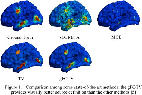 Figure From Improving Eeg Source Localization With A Novel