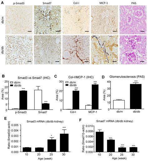 AANG Prevents Smad3 Dependent Diabetic Nephropathy By Restoring