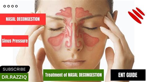 Nasal Congestion Dr Razziq Best Technique And Tips To Study Ent