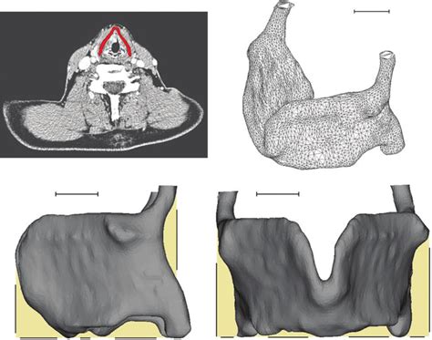 Thyroid Cartilage Model Formation A The Area Of Interest At Dicom Download Scientific