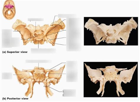 Skull Bones Sphenoid Bone Diagram Quizlet