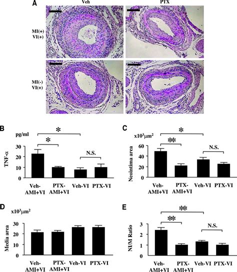 Inflammatory Response To Acute Myocardial Infarction Augments