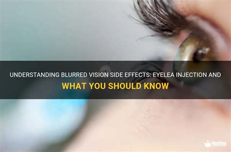 Understanding Blurred Vision Side Effects Eyelea Injection And What