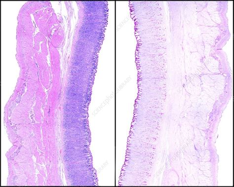 Stomach Wall Light Micrograph Stock Image C Science