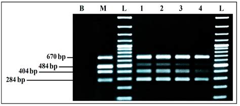 Ijerph Free Full Text Simultaneous Detection Of Four Main Foodborne