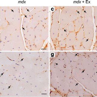 Representative Photomicrographs Of Ohdg Immunohistochemistry In