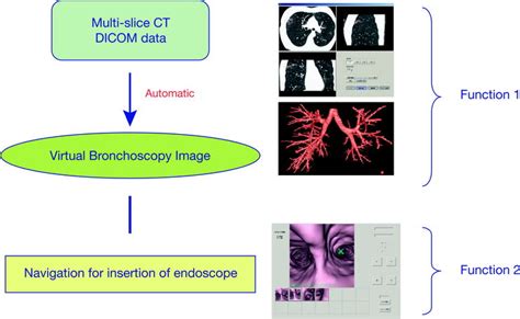 Image-Guided Bronchoscopy | Radiology Key