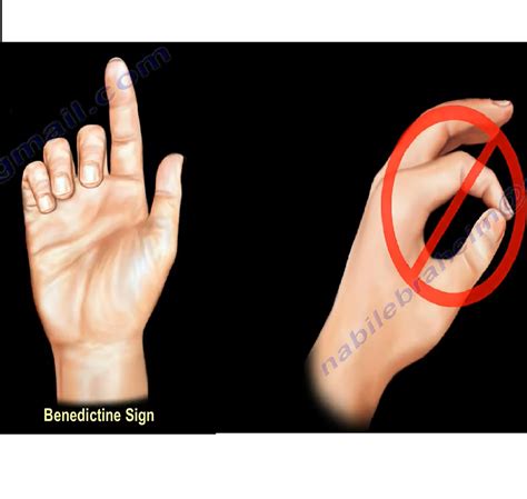 Anterior Interosseous Nerve Injury — OrthopaedicPrinciples.com