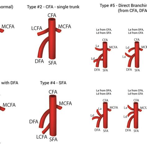 Pdf The Variable Origin Of The Lateral Circumfloex Femoral Artery A Meta Analysis And