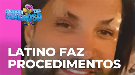 Latino Faz Procedimentos Est Ticos No Rosto E Seguidores Questionam