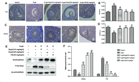 Effects Of Daph On P And Klotho Expression A C The Ihc Staining