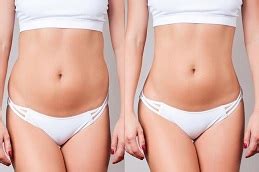 Body Contouring Treatment In Dubai Abu Dhabi Body Reshaping Cost