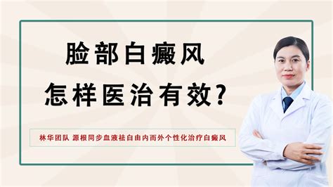 北京国丹医院林华医生分享：脸部白癜风怎样医治有效 哔哩哔哩