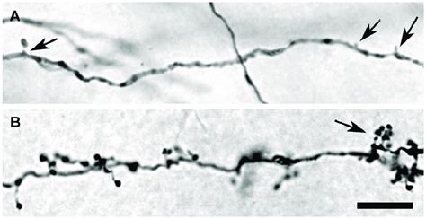 Micrographs Showing The Morphology Of Bda Labeled Dendrites And Axons