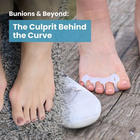 Bunion Correctors Toe Spacers Bunion Pain Relief Natural Foot Health