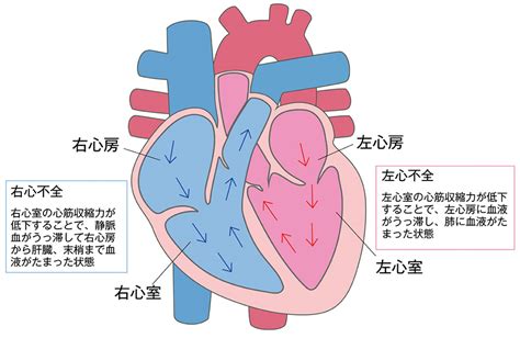 心不全の分類 循環器疾患の病態と治療 循環器情報サイトassist 第一三共エスファ