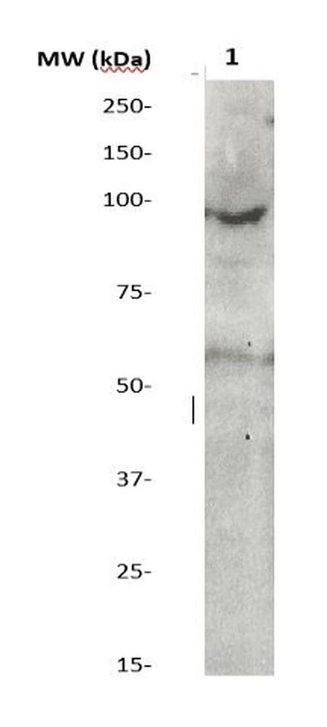 Phospho Stat3 Ser727 Polyclonal Antibody 500 12044