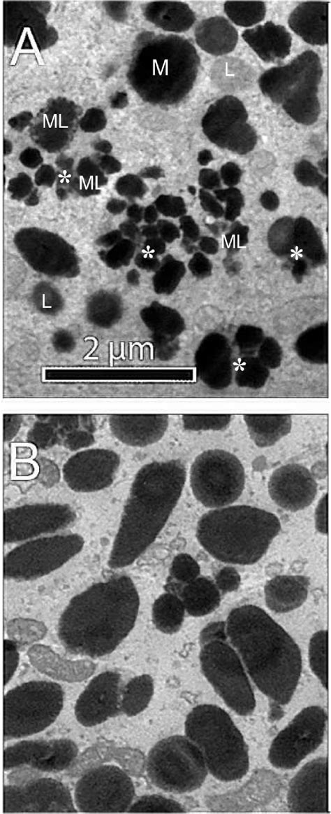 Ultrastructure Of Pigments In Cultured Human Rpe Cells A