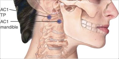 OPP Anterior Cervical Counterstrain Flashcards Quizlet