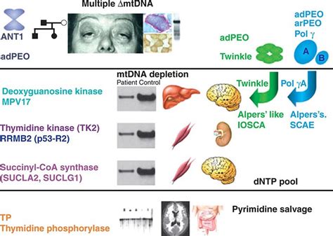 Mitochondrial Dna And Heritable Traits And Diseases Basicmedical Key