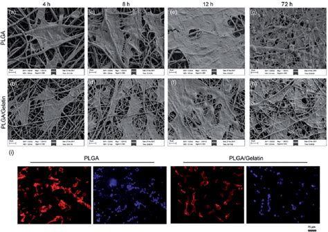 Figure 1 From Electrospun PLGA And PLGA Gelatin Scaffolds For