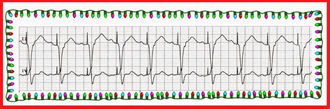 Practice EKG Strips Merry Christmas