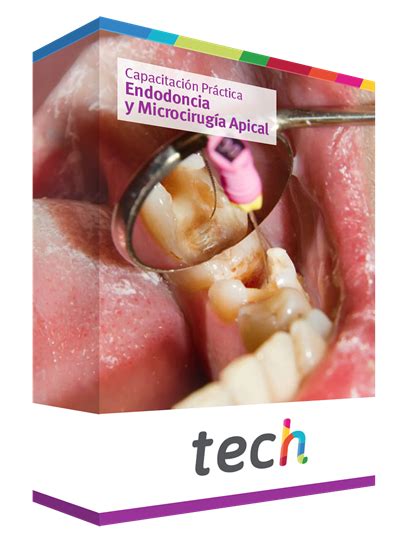 Capacitación Práctica en Endodoncia y Microcirugía Apical TECH Portugal