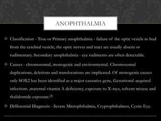 Anophthalmia poster final | PPT