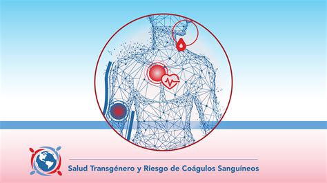 Signos y síntomas de un coágulo sanguíneo Coágulos de sangre y salud