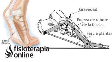 Qué es la fascitis plantar Causas diagnóstico y tratamiento