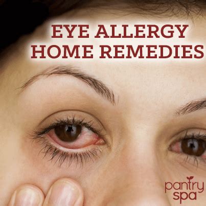 Eye Allergies: Natural Remedies For Itchy, Red & Watery Eyes