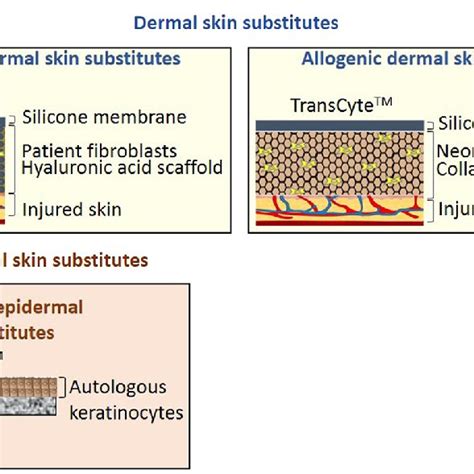 Schematic Representation Of A Dermal Skin Substitutes And B Epidermal