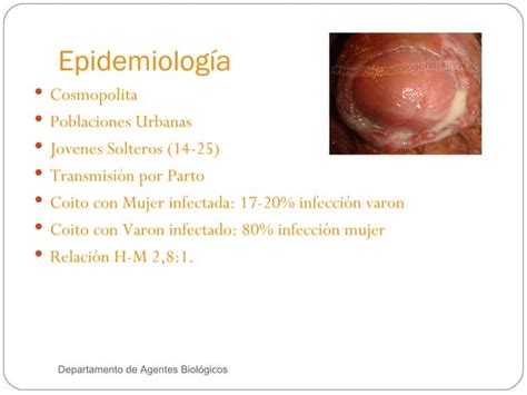 Neisseria Gonorrhoeae Ppt