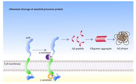 Amyloidosis In Alzheimers Disease Encyclopedia Mdpi